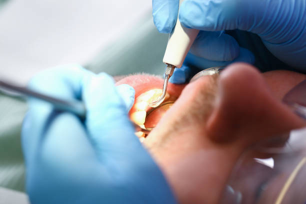 Best Urgent Tooth Repair  in Emigration Canyon, UT